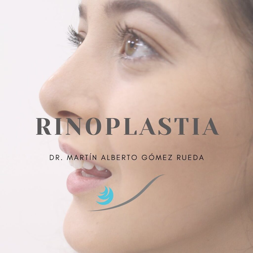 rinoplastia