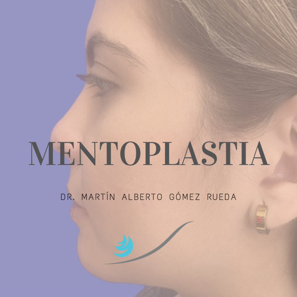 Mentoplastia