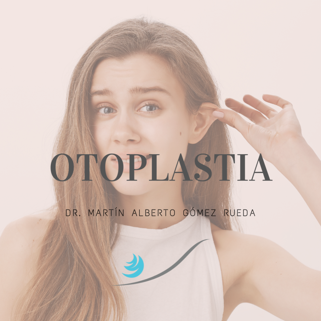 Otoplastia